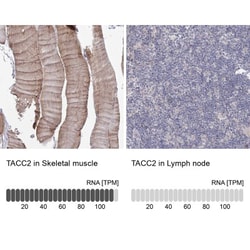 TACC2 Antibody, Novus Biologicals 0.1mL; Unlabeled:Antibodies, Polyclonal